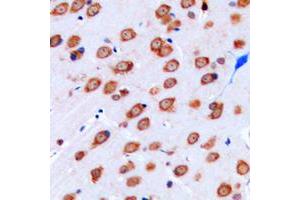 Immunohistochemical analysis of Kir3. (KCNJ9 anticorps  (Center))