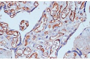 Immunohistochemistry of paraffin-embedded Human placenta using CD34 Polyclonal Antibody at dilution of 1:100 (40x lens). (CD34 anticorps)