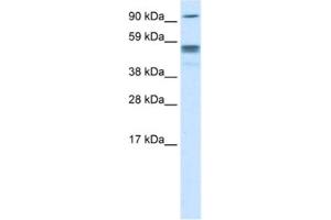 Western Blotting (WB) image for anti-Septin 4 (SEPT4) antibody (ABIN2463655) (Septin 4 anticorps)