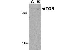 Western blot analysis of TOR in L1210 cell lysate with this product at (A) 1 and (B) 2 μg/ml.