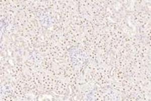 Immunohistochemistry analysis of paraffin-embedded rat kidney using,TORC1 (ABIN7073590) at dilution of 1: 800 (CRTC1 anticorps)