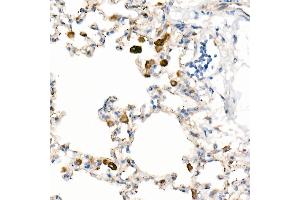 Immunohistochemistry of paraffin-embedded Rat lung using CD63 antibody (ABIN7266210) at dilution of 1:200 (40x lens). (CD63 anticorps)