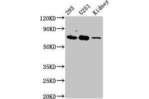 Western Blot Positive WB detected in: 293 whole cell lysate, U251 whole cell lysate, Rat kidney tissue All lanes: EOMES antibody at 4. (EOMES anticorps  (AA 562-676))