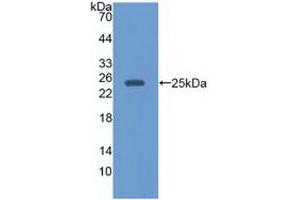 Western blot analysis of recombinant Human EBI3. (EBI3 anticorps)