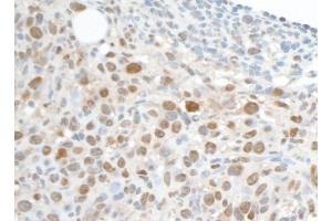 Immunohistochemistry (IHC) image for anti-Proliferating Cell Nuclear Antigen (PCNA) antibody (ABIN7453982)