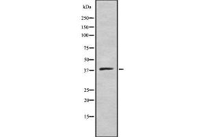 Western blot analysis of ELAV2/4 using COLO205 whole cell lysates (ELAV2/4 anticorps)