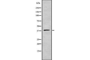 Western blot analysis of ELAV2/4 using COLO205 whole cell lysates