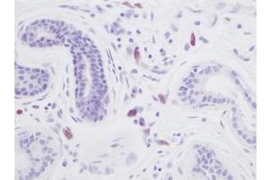 anti-Interleukin 8 (IL8) antibody