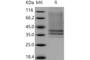 Western Blotting (WB) image for Interleukin 7 Receptor (IL7R) protein (His tag) (ABIN7320411)