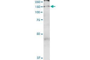 Immunoprecipitation of TBC1D1 transfected lysate using anti-TBC1D1 MaxPab rabbit polyclonal antibody and Protein A Magnetic Bead , and immunoblotted with TBC1D1 purified MaxPab mouse polyclonal antibody (B01P) .