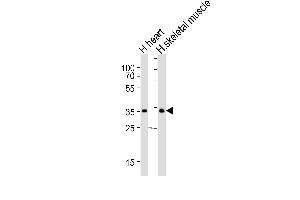 Western blot analysis of lysates from human heart and human skeletal muscle tissue lysate (from left to right), using DIO2 Antibody (Center) (ABIN652664 and ABIN2842445).