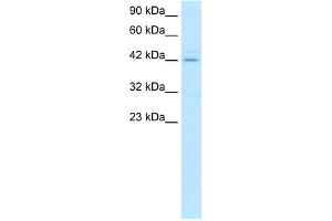 WB Suggested Anti-HOXA10 Antibody Titration:  0. (HOXA10 anticorps  (N-Term))