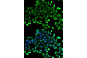 Immunofluorescence analysis of A549 cells using COMMD1 antibody (ABIN5974300). (COMMD1 anticorps)