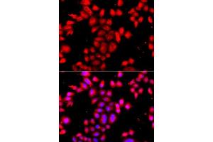 Immunofluorescence analysis of A549 cells using OSGEPL1 antibody. (OSGEPL1 anticorps  (AA 1-270))