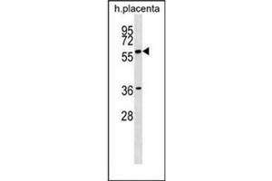 Western blot analysis of GAB3 Antibody (N-term) in human placenta tissue lysates (35ug/lane).