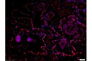 Paraformaldehyde-fixed, paraffin embedded human prostate tissue, Antigen retrieval by boiling in sodium citrate buffer(pH6) for 15min, Block endogenous peroxidase by 3% hydrogen peroxide for 30 minutes, Blocking buffer (normal goat serum) at 37°C for 20min, Antibody incubation with Rabbit Anti-DMA/Dmrt1a Polyclonal Antibody, Unconjugated  at 1:500 overnight at 4°C, followed by a conjugated secondary and DAB staining (DMO/Dmrt1a (AA 51-100) anticorps)