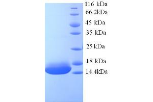 SDS-PAGE (SDS) image for Cyclin J-Like (CCNJL) (AA 315-435), (partial) protein (His tag) (ABIN5713328) (CCNJL Protein (AA 315-435, partial) (His tag))