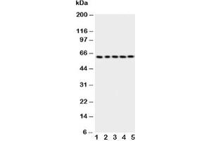 Western blot testing of p63 antbody; Lane 1: HeLa;  2: SMMC-7721;  3: COLO320;  4: A549;  5: SGC cell lysate (TCP1 alpha/CCTA anticorps  (AA 82-98))