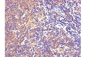 IHC image of ABIN7143989 diluted at 1:300 and staining in paraffin-embedded human lymph node tissue performed on a Leica BondTM system.
