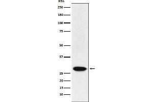 Western blot analysis of MAD3 expression in HeLa cell lysate.