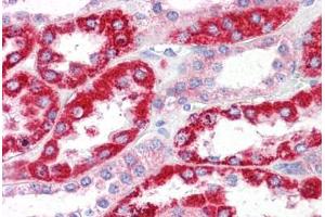 Human Kidney: Formalin-Fixed, Paraffin-Embedded (FFPE) (OCIAD2 anticorps  (N-Term))