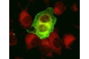 Immunofluorescence (IF) image for anti-Herpes Simplex Virus Type 1, Glycoprotein C (HSV1 gC) antibody (ABIN265558) (HSV-1 gC anticorps)