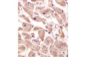 Antibody staining VLDLR in human heart tissue sections by Immunohistochemistry (IHC-P - paraformaldehyde-fixed, paraffin-embedded sections).