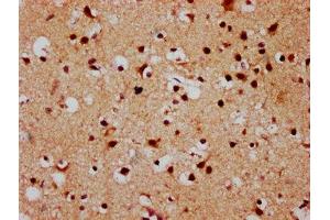 IHC image of ABIN7152883 diluted at 1:500 and staining in paraffin-embedded human brain tissue performed on a Leica BondTM system. (FSD1 anticorps  (AA 251-370))