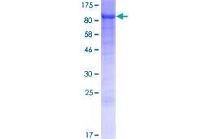 Image no. 1 for Acyl-CoA Synthetase Long-Chain Family Member 5 (ACSL5) (AA 1-739) protein (GST tag) (ABIN1305719)