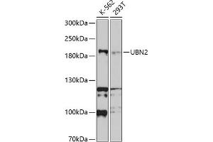 Western blot analysis of extracts of various cell lines, using UBN2 antibody (ABIN6135065, ABIN6149857, ABIN6149858 and ABIN6214800) at 1:1000 dilution.