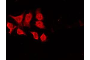 ABIN6268645 staining HeLa by IF/ICC. (CHEK1 anticorps  (Internal Region))