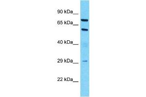 Host:  Rabbit  Target Name:  MUC13  Sample Type:  Lymph Node Tumor lysates  Antibody Dilution:  1. (MUC13 anticorps  (C-Term))