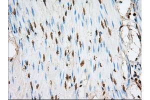 Immunohistochemical staining of paraffin-embedded liver tissue using anti-ACSBG1 mouse monoclonal antibody. (ACSBG1 anticorps)