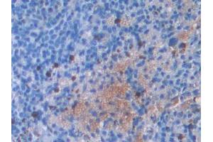 Used in DAB staining on fromalin fixed paraffin- embedded stomach tissue (IL2RG anticorps  (AA 23-263))