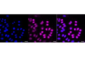 Immunocytochemical staining of HepG2 cells with Cyclin dependent kinase 1 antibody (ABIN7798206), 1:1,000). (Recombinant CDK1 anticorps)