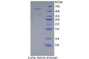 SDS-PAGE analysis of Rat Collagen Type XVIII Protein. (COL18 Protéine)
