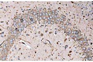 IHC analysis of FXR1 using anti-FXR1 antibody (ABIN7600093). (FXR1 anticorps  (AA 149-614))