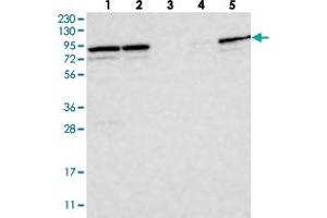 Western blot analysis of Lane 1: RT-4, Lane 2: U-251 MG, Lane 3: Human Plasma, Lane 4: Liver, Lane 5: Tonsil with PARP6 polyclonal antibody  at 1:250-1:500 dilution. (PARP6 anticorps)