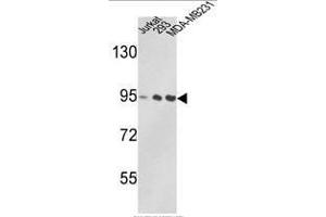Western blot analysis of VCP Antibody (C-term) in Jurkat, 293, MDA-MB231 cell line lysates (35ug/lane). (VCP anticorps  (C-Term))
