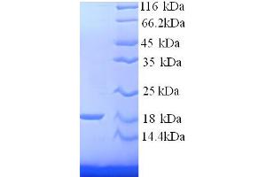 SDS-PAGE (SDS) image for Hemoglobin, beta Adult Minor Chain (HBB-B2) (AA 2-147) protein (His tag) (ABIN5714194)
