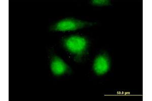 Immunofluorescence of purified MaxPab antibody to OSTF1 on HeLa cell. (OSTF1 anticorps  (AA 1-217))