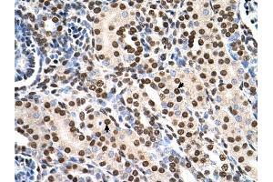 RSU1 antibody was used for immunohistochemistry at a concentration of 4-8 ug/ml to stain Epithelial cells of renal tubule (arrows) in Human Kidney. (RSU1 anticorps  (C-Term))