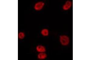 ABIN6275799 staining HepG2 by IF/ICC.