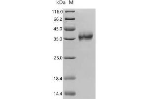Epithelial Cell Adhesion Molecule (EPCAM) (AA 24-265) protein (His-G4S-Avi Tag)