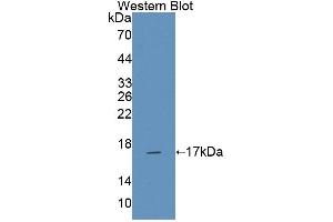 Figure. (NCR3 anticorps  (AA 21-147))