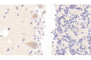 Detection of PLB in Human Cerebellum Tissue using Polyclonal Antibody to Phospholipase B (PLB) (Phospholipase B anticorps  (AA 1036-1458))