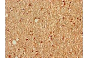 Immunohistochemistry of paraffin-embedded human brain tissue using ABIN7168669 at dilution of 1:100