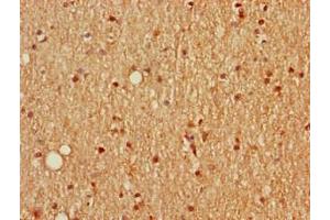 Immunohistochemistry of paraffin-embedded human brain tissue using ABIN7168669 at dilution of 1:100 (SCGN anticorps  (AA 1-276))