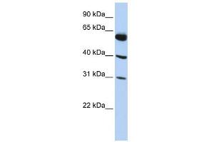 LYSMD4 antibody used at 1 ug/ml to detect target protein. (LYSMD4 anticorps  (N-Term))