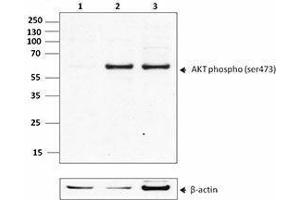 Western Blotting (WB) image for anti-V-Akt Murine Thymoma Viral Oncogene Homolog 1 (AKT1) (phosphorylated) antibody (ABIN2666091) (AKT1 anticorps  (phosphorylated))
